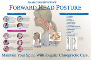 1-forward-head-posture