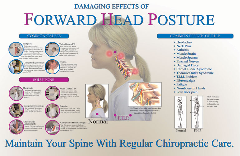 Yoga Anatomy: Different Types of Forward Head Posture and How to