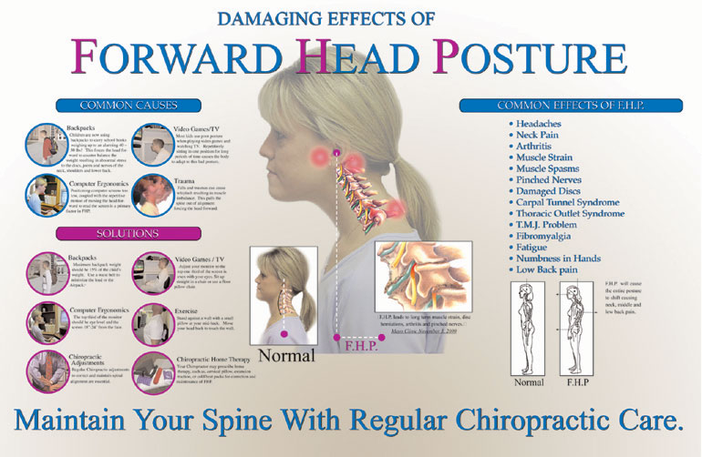 forward head posture exercises correcting