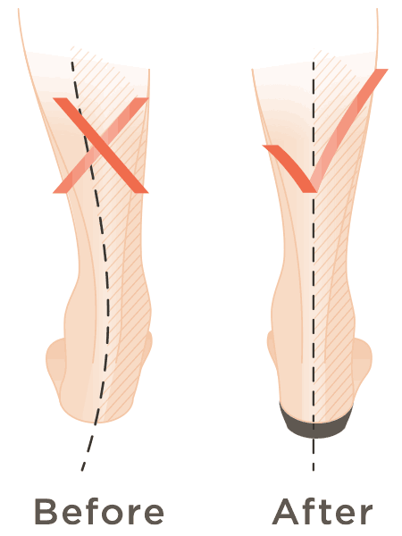 orthotics for standing all day